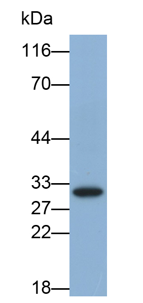 Monoclonal Antibody to HLA Class II Histocompatibility Antigen, DR Alpha Chain (HLA-DRA)