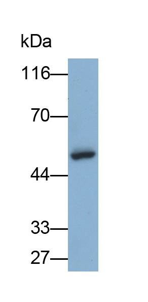 Monoclonal Antibody to Bleomycin Hydrolase (BLMH)