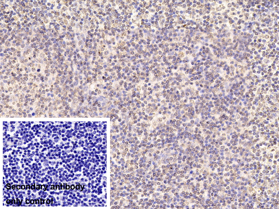 Monoclonal Antibody to Promyelocytic Leukemia Protein (PML)