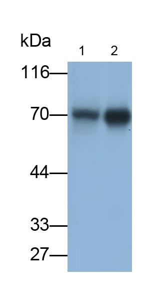Monoclonal Antibody to Zyxin (ZYX)
