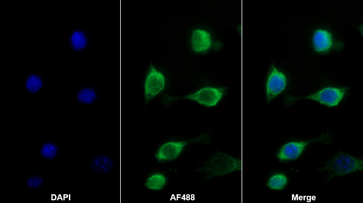 Monoclonal Antibody to Allograft inflammatory factor 1 (AIF1)