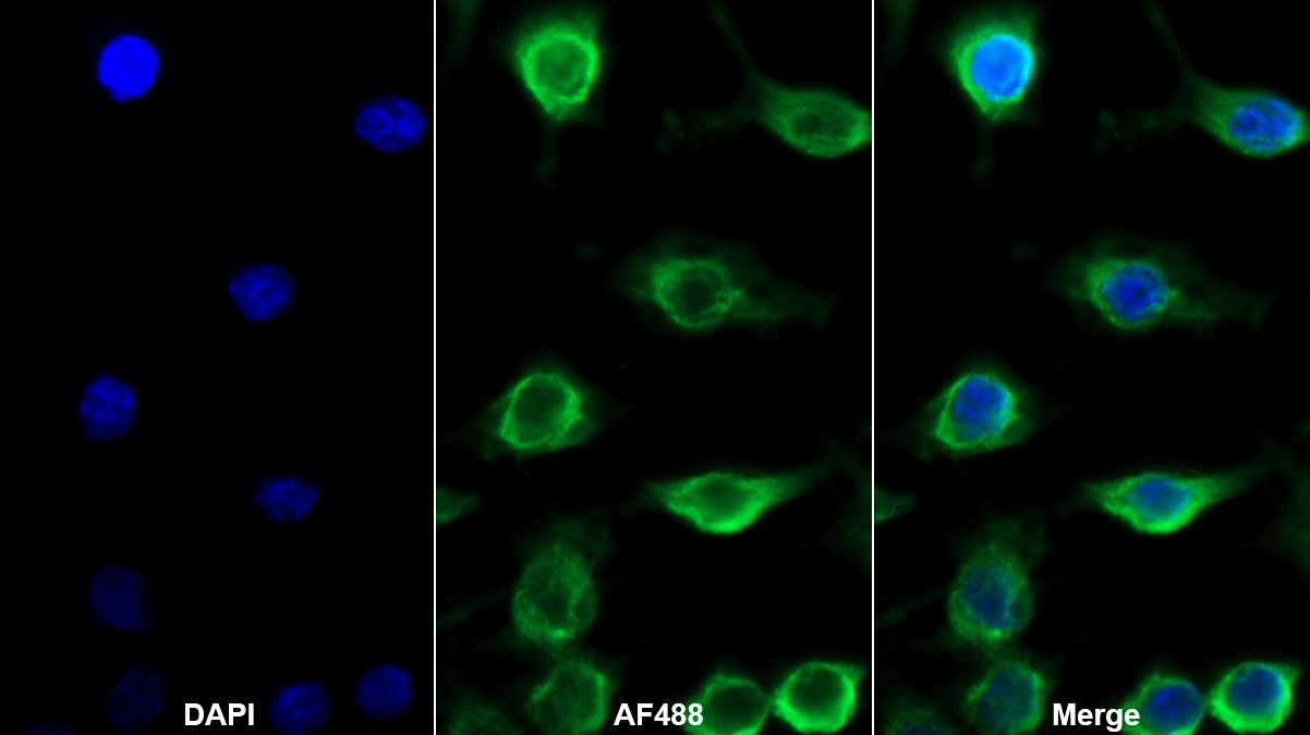 Monoclonal Antibody to Allograft inflammatory factor 1 (AIF1)