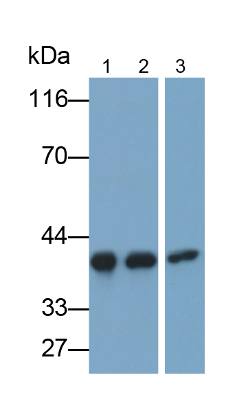 Monoclonal Antibody to Aminolevulinate Delta Dehydratase (ALAD)