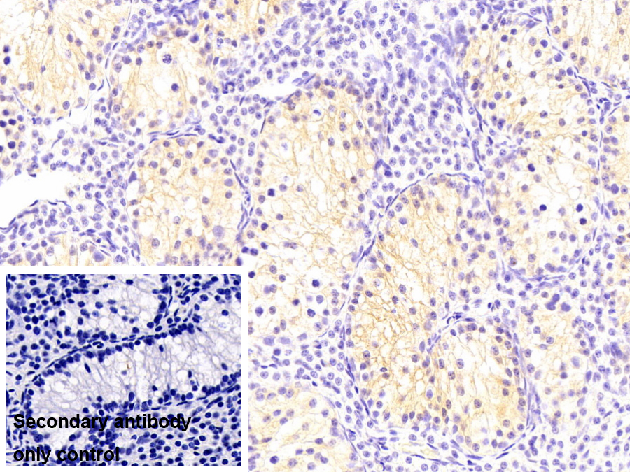 Monoclonal Antibody to Argininosuccinate Synthetase 1 (ASS1)