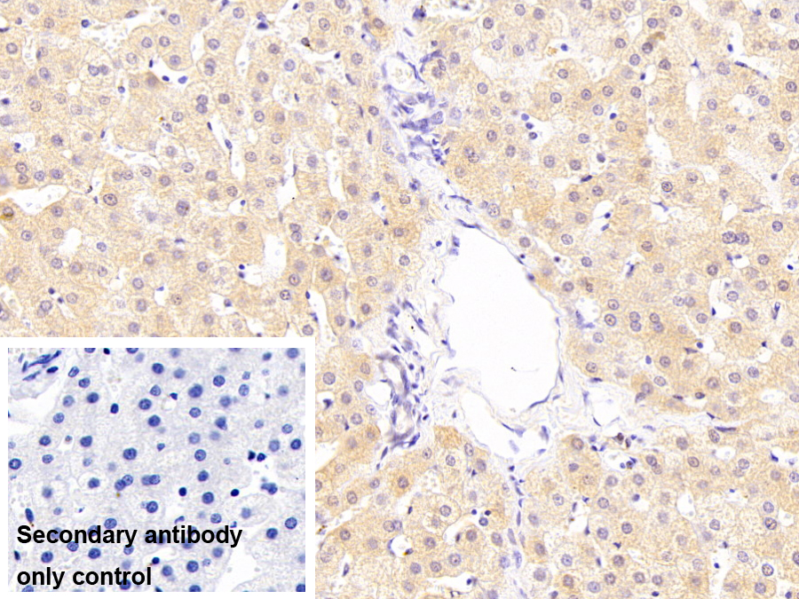 Monoclonal Antibody to Carbonyl Reductase 1 (CBR1)