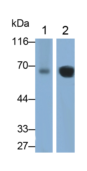 Monoclonal Antibody to Catalase (CAT)