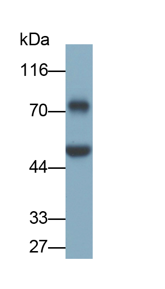 Monoclonal Antibody to Extracellular Matrix Protein 1 (ECM1)