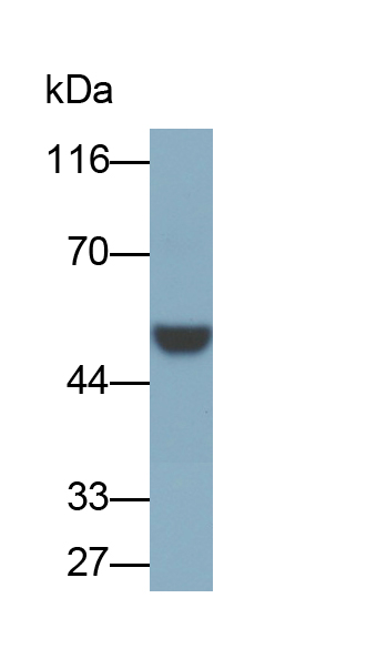 Monoclonal Antibody to Extracellular Matrix Protein 1 (ECM1)