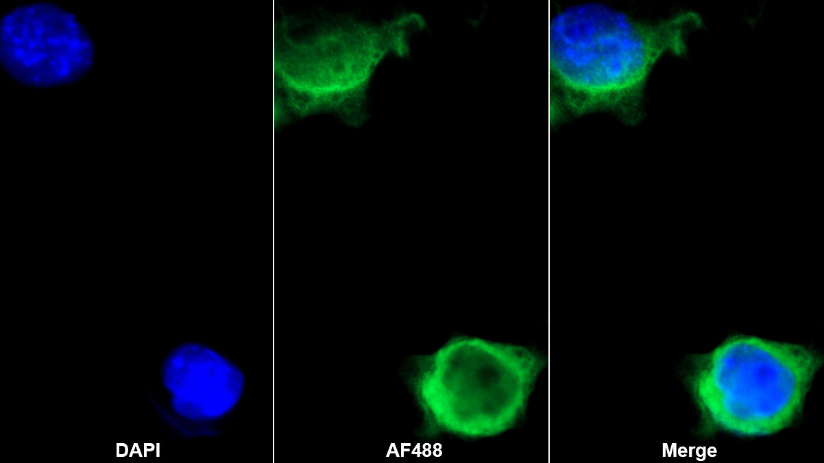 Monoclonal Antibody to Fibulin 1 (FBLN1)