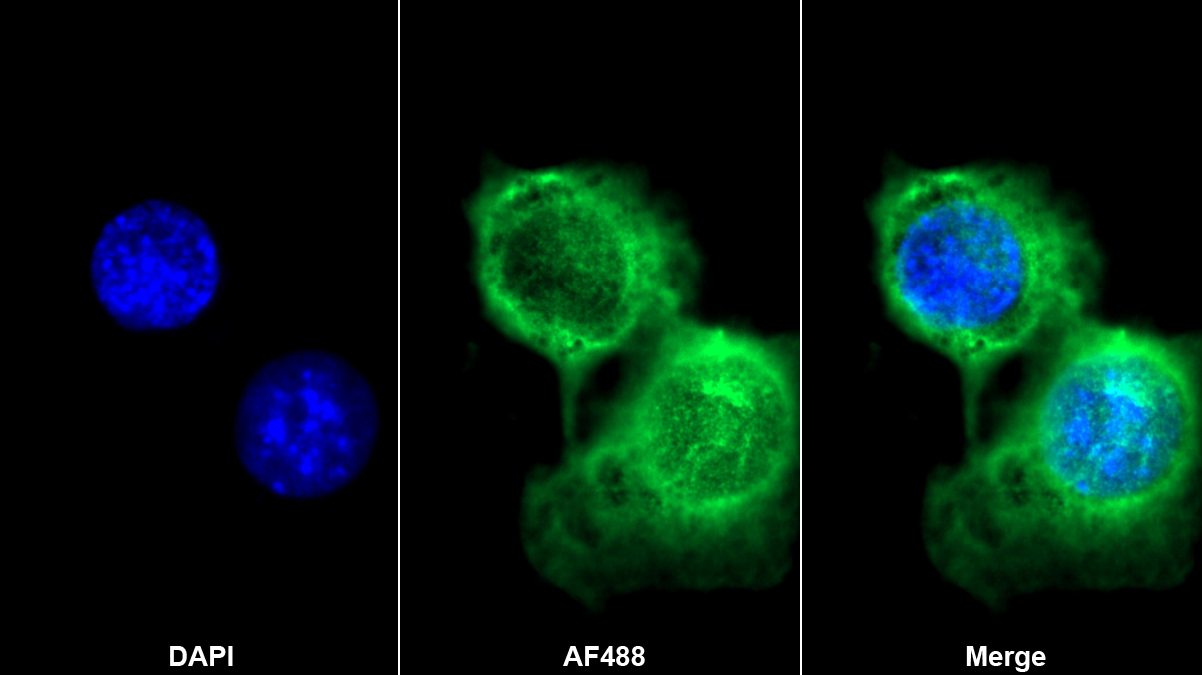 Monoclonal Antibody to Fibulin 1 (FBLN1)