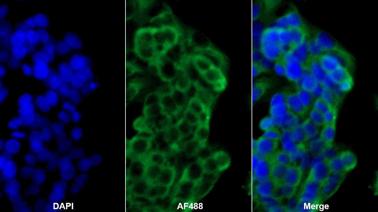 Monoclonal Antibody to Ferroportin (FPN)