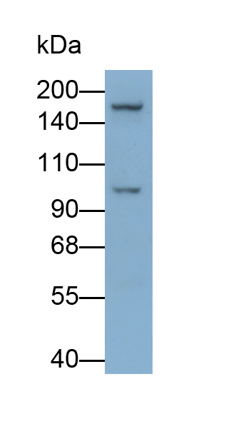 Monoclonal Antibody to Insulin Receptor Substrate 1 (IRS1)