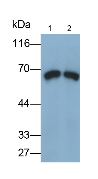 Monoclonal Antibody to L-Plastin (LCP1)