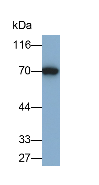 Monoclonal Antibody to L-Plastin (LCP1)