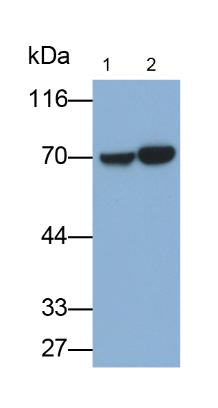 Monoclonal Antibody to L-Plastin (LCP1)