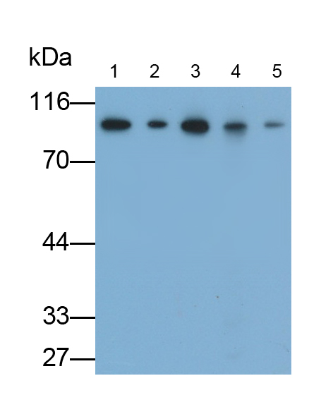 Monoclonal Antibody to Valosin Containing Protein (VCP)