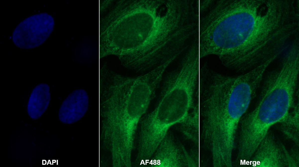 Monoclonal Antibody to Insulin Like Growth Factor Binding Protein 5 (IGFBP5)