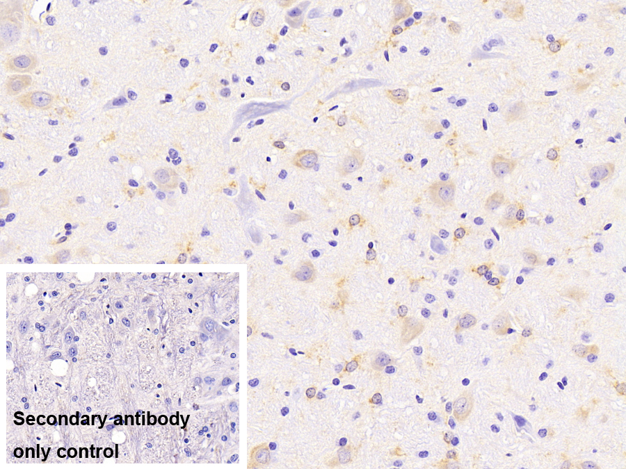 Monoclonal Antibody to Peripheral Myelin Protein 22 (PMP22)