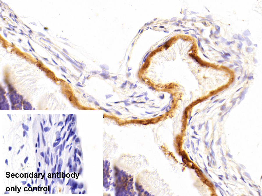 Monoclonal Antibody to Retinaldehyde Binding Protein 1 (RLBP1)