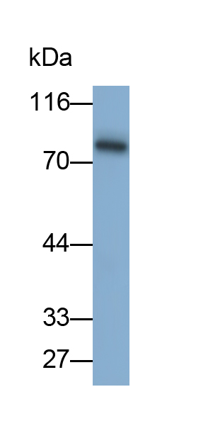 Monoclonal Antibody to Tumor Protein P63 (TP63)