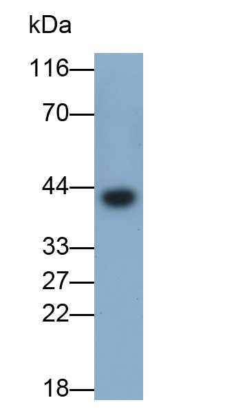 Monoclonal Antibody to Tumor Susceptibility Gene 101 (TSG101)