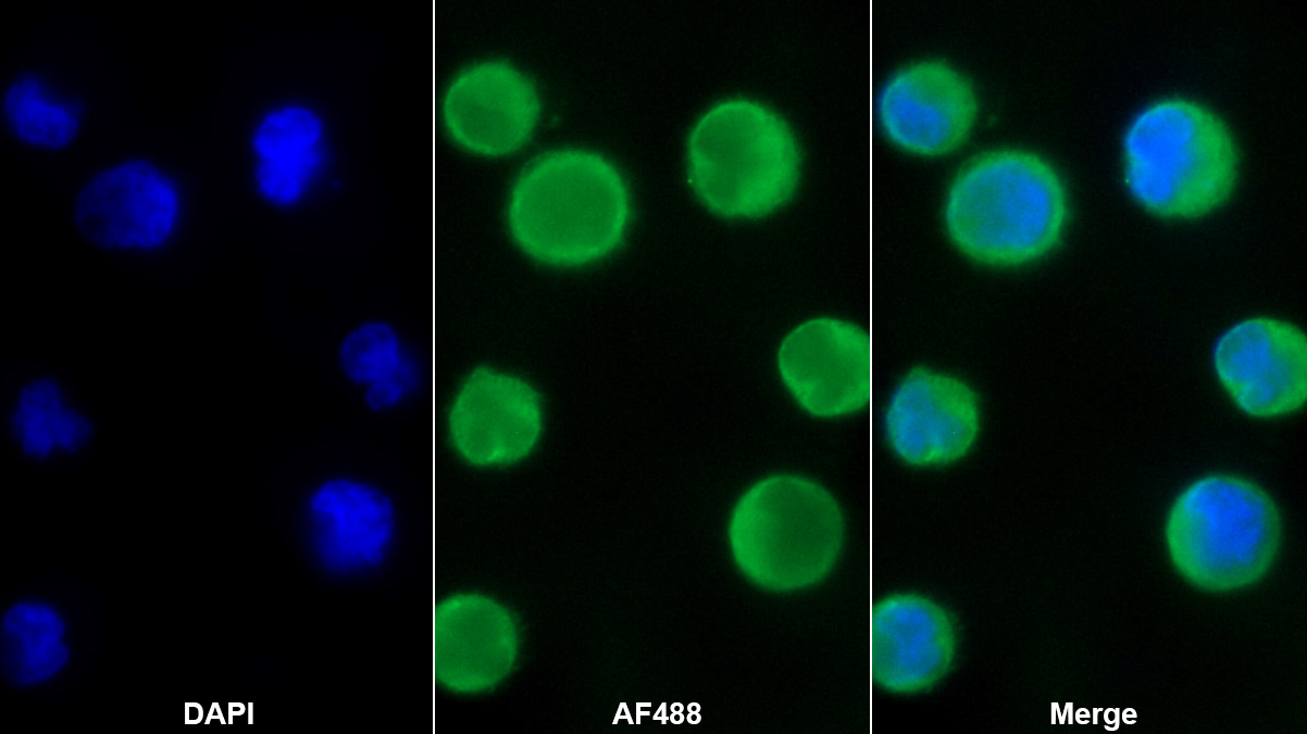 Monoclonal Antibody to Stanniocalcin 1 (STC1)