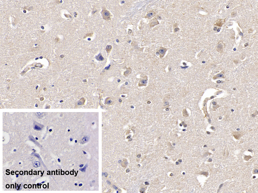 Monoclonal Antibody to Fibroblast Growth Factor 13 (FGF13)
