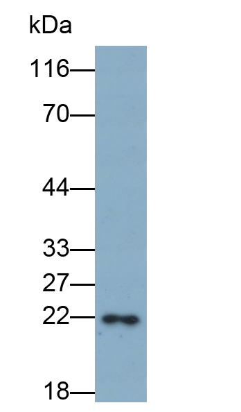 Monoclonal Antibody to Crystallin Alpha B (CRYaB)