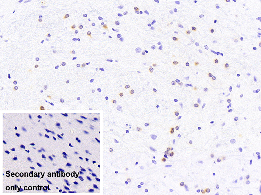 Monoclonal Antibody to Crystallin Alpha B (CRYaB)