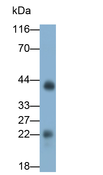 Monoclonal Antibody to Crystallin Alpha B (CRYaB)