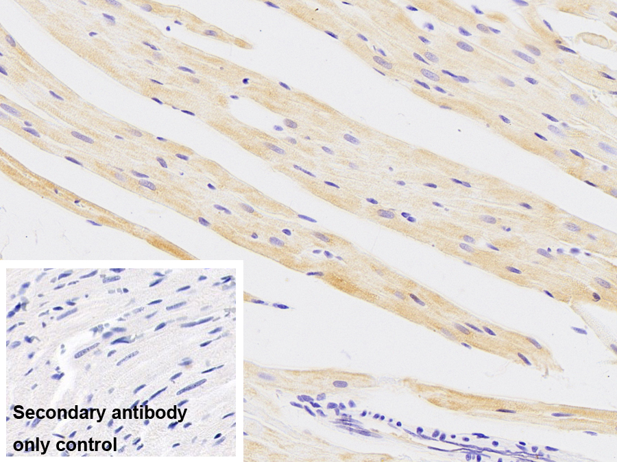 Monoclonal Antibody to Crystallin Alpha B (CRYaB)