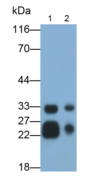 Monoclonal Antibody to Cathepsin B (CTSB)