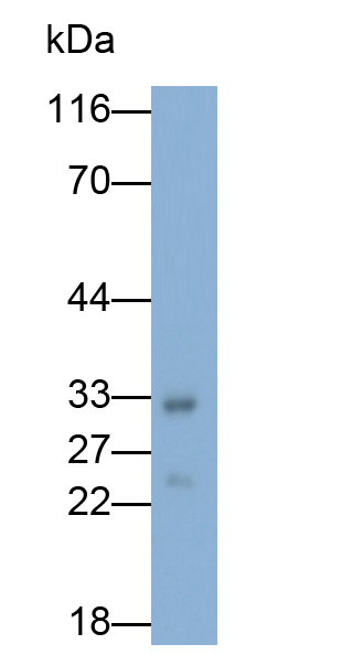 Monoclonal Antibody to Cathepsin B (CTSB)