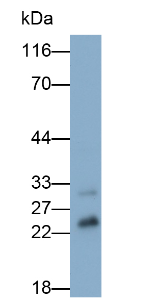 Monoclonal Antibody to Cathepsin B (CTSB)