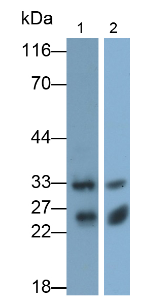 Monoclonal Antibody to Cathepsin B (CTSB)