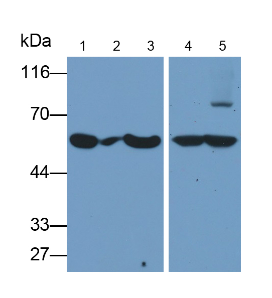 Monoclonal Antibody to Carcinoembryonic Antigen Related Cell Adhesion Molecule 1 (CEACAM1)