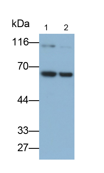 Monoclonal Antibody to Arginyl tRNA Synthetase (RARS)