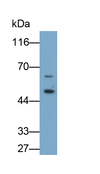 Monoclonal Antibody to Gastric Intrinsic Factor (GIF)