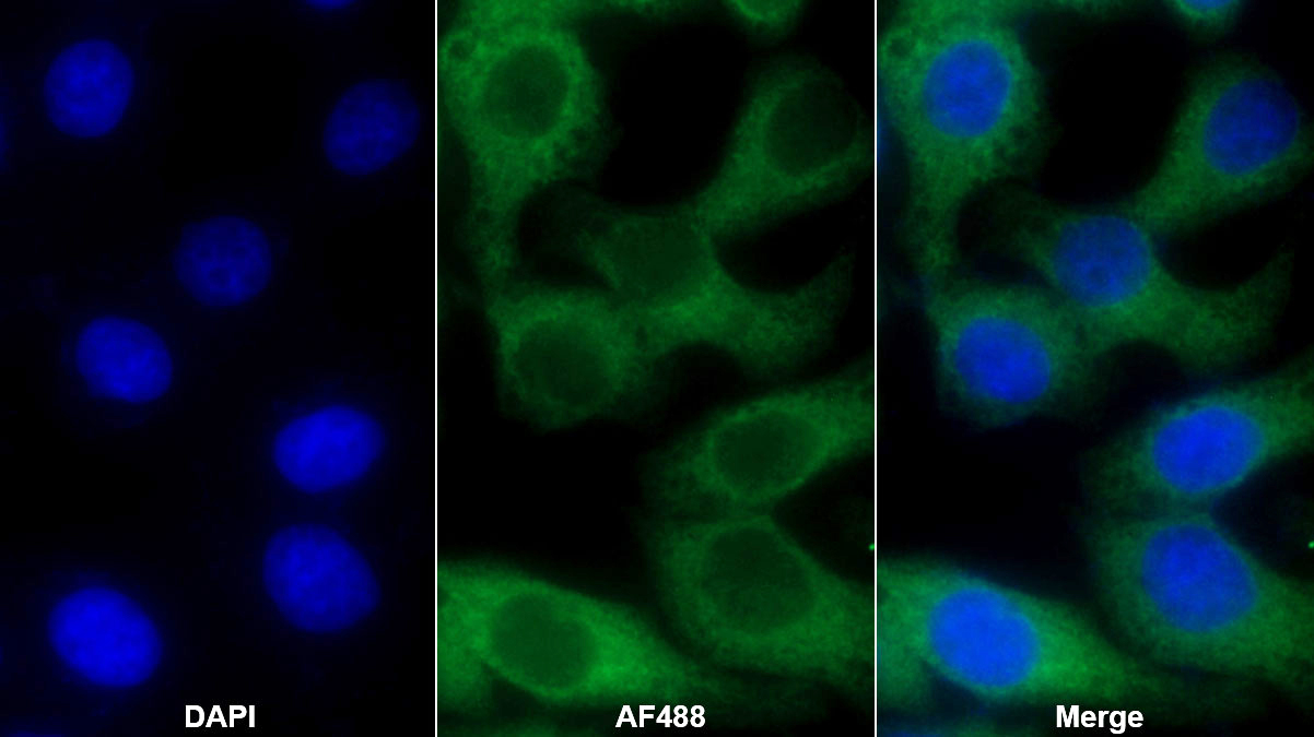 Monoclonal Antibody to Chorionic Gonadotropin Beta Polypeptide (CGb)