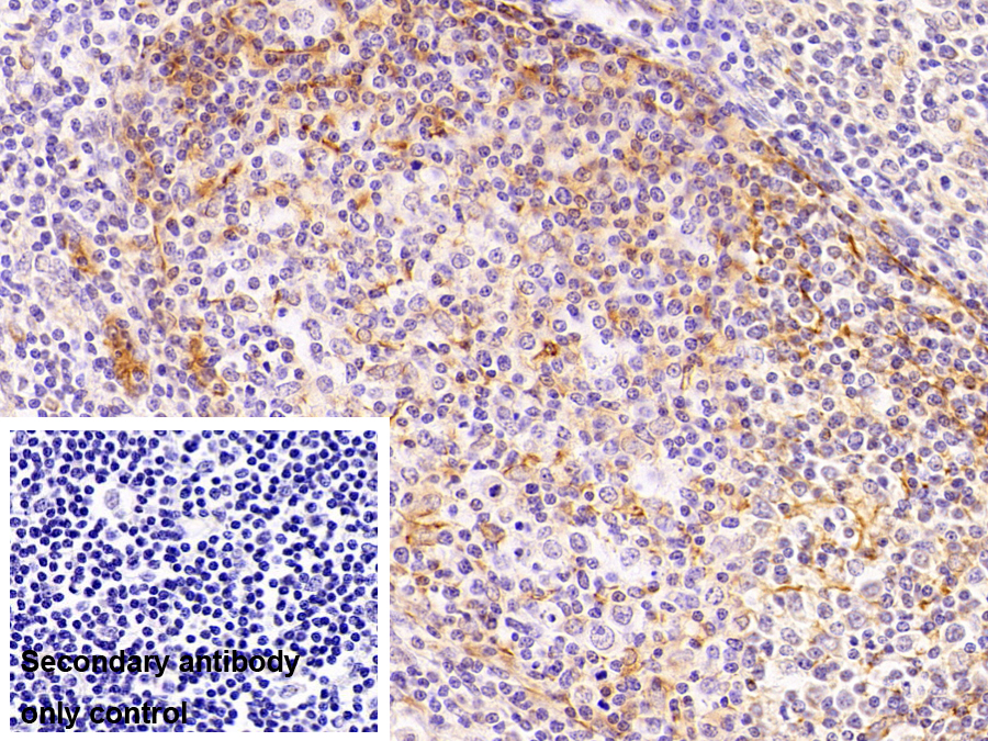 Monoclonal Antibody to Keratin 6A (KRT6A)