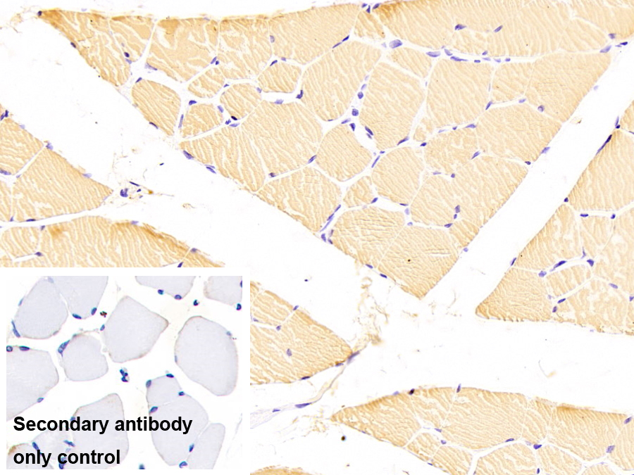 Monoclonal Antibody to Myosin Light Chain 3, Alkali, Ventricular, Slow Skeletal (MYL3)