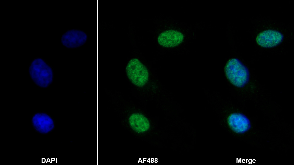 Monoclonal Antibody to Aryl Hydrocarbon Receptor Nuclear Translocator (ARNT)