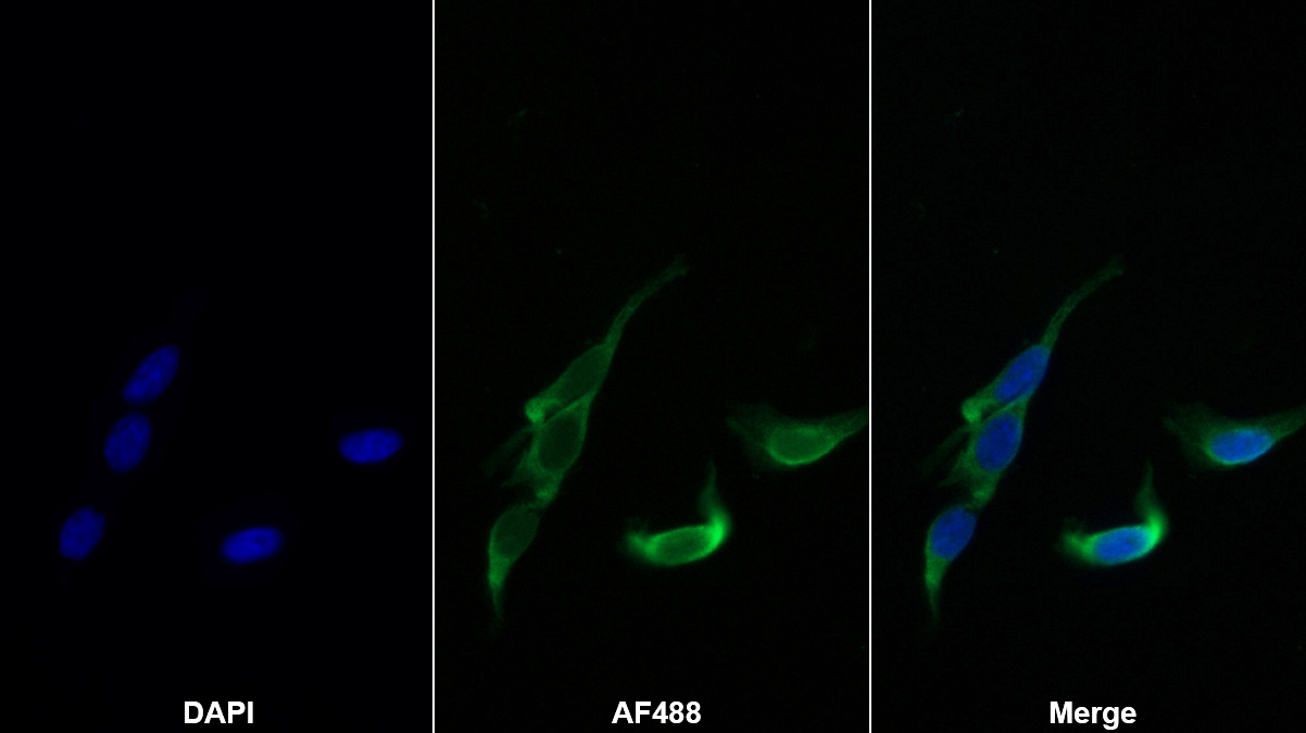 Monoclonal Antibody to Apolipoprotein L2 (APOL2)