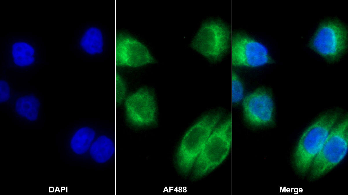 Monoclonal Antibody to ATP Binding Cassette Transporter A3 (ABCA3)