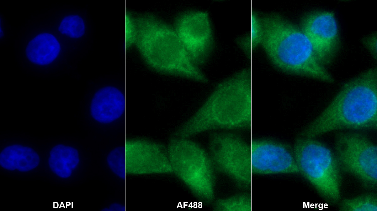 Monoclonal Antibody to ATP Binding Cassette Transporter A3 (ABCA3)