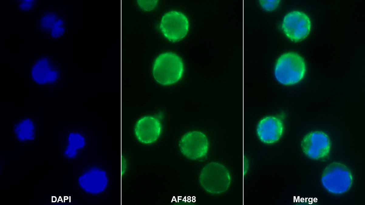 Monoclonal Antibody to Na-Cl Cotransporter (NCCT)