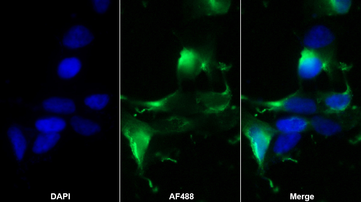 Monoclonal Antibody to Sodium/Glucose Cotransporter 1 (SGLT1)
