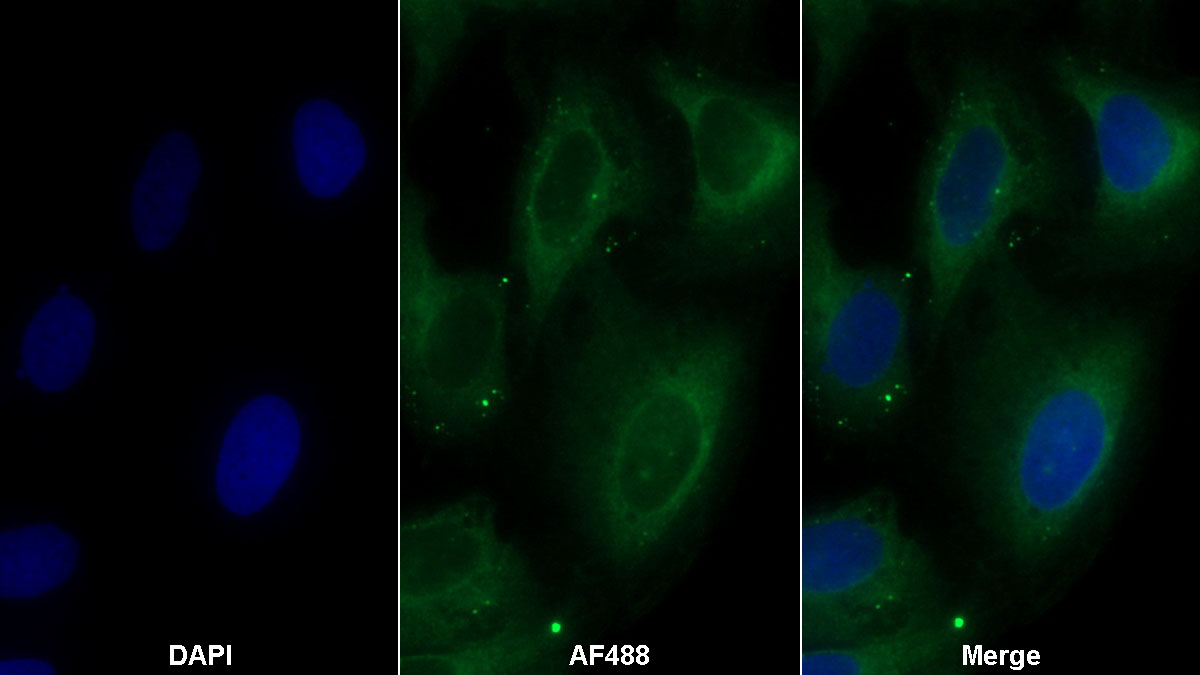 Monoclonal Antibody to Organic Cation/Ergothioneine Transporter (OCTN1)