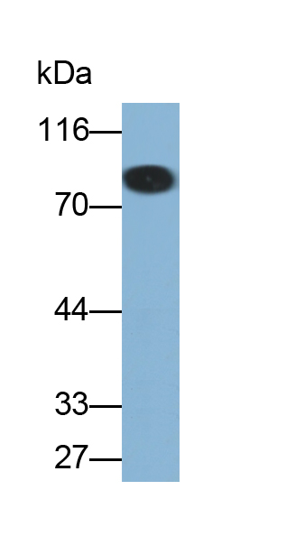 Monoclonal Antibody to Alpha-1-B-Glycoprotein (a1BG)