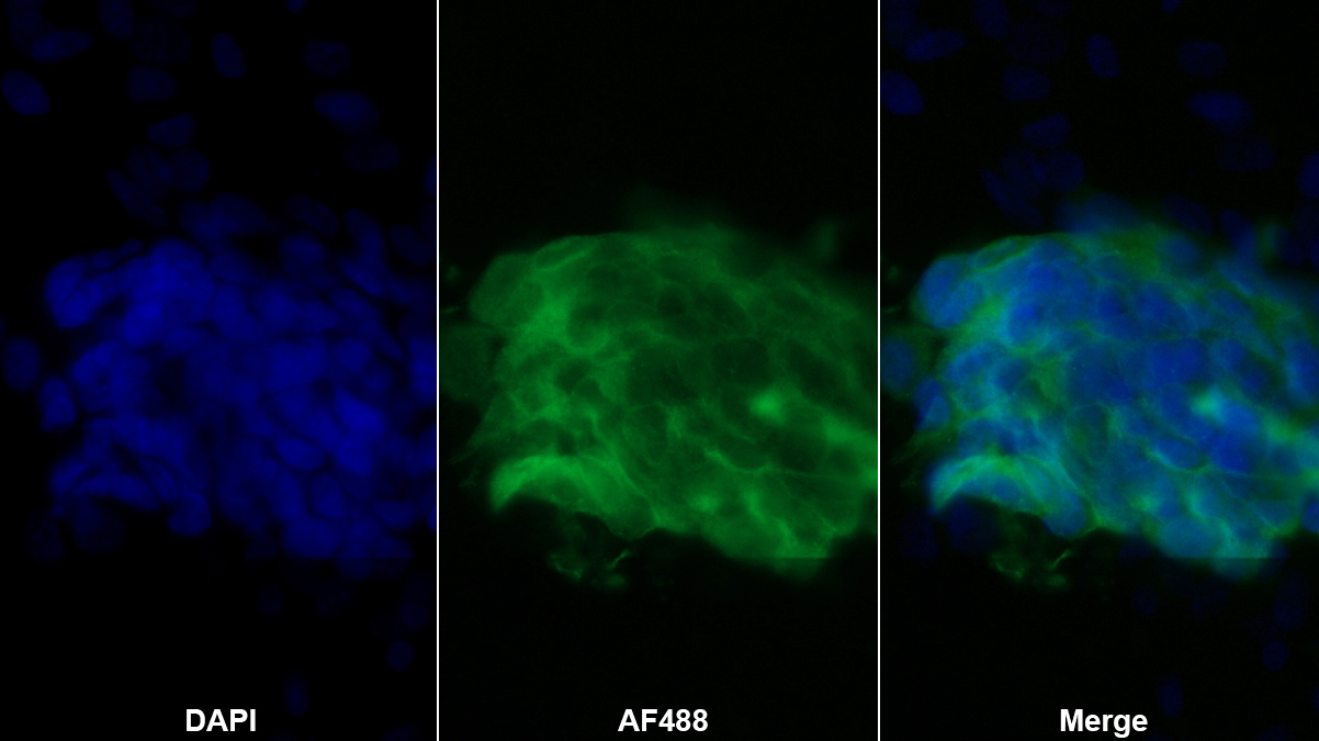 Monoclonal Antibody to Regenerating Islet Derived Protein 3 Alpha (REG3a)